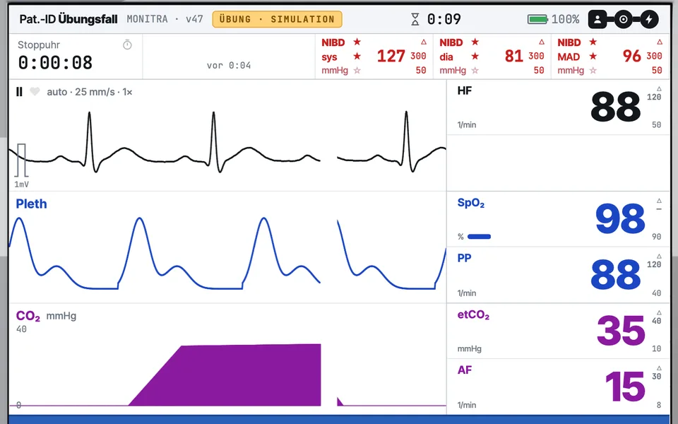 MONITRA: Notfallmonitor mit simuliertem EKG, Pleth- und CO₂-Kurve, Blutdruck und Sättigung